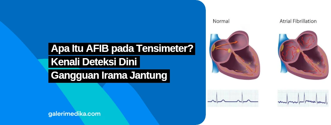 Apa Itu AFIB pada Tensimeter? Kenali Deteksi Dini Gangguan Irama Jantung Apa Itu AFIB pada Tensimeter? Kenali Deteksi Dini Gangguan Irama Jantung