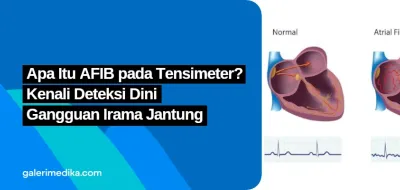 Apa Itu AFIB pada Tensimeter? Kenali Deteksi Dini Gangguan Irama Jantung