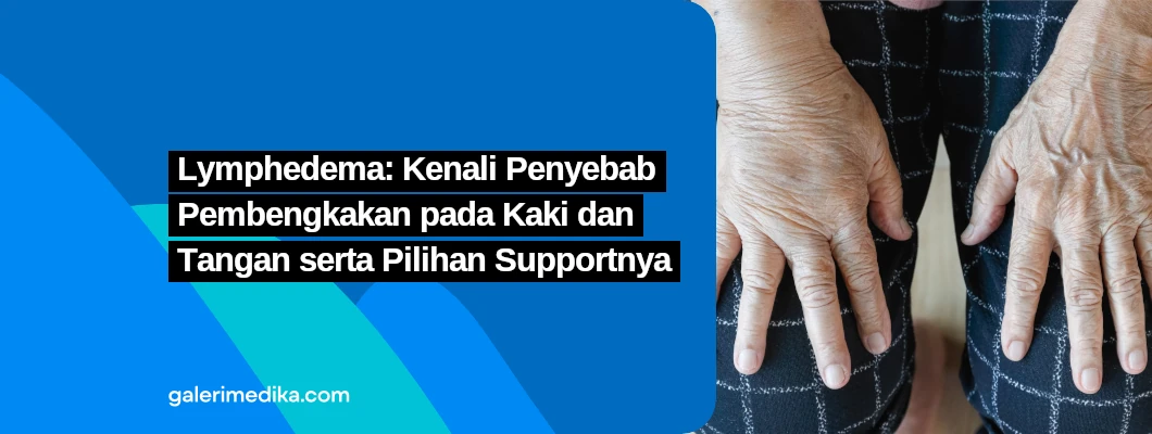 Lymphedema: Kenali Penyebab Pembengkakan pada Kaki dan Tangan serta Pilihan Supportnya Lymphedema: Kenali Penyebab Pembengkakan pada Kaki dan Tangan serta Pilihan Supportnya
