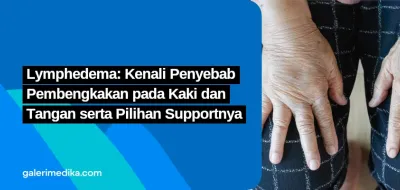 Lymphedema: Kenali Penyebab Pembengkakan pada Kaki dan Tangan serta Pilihan Supportnya