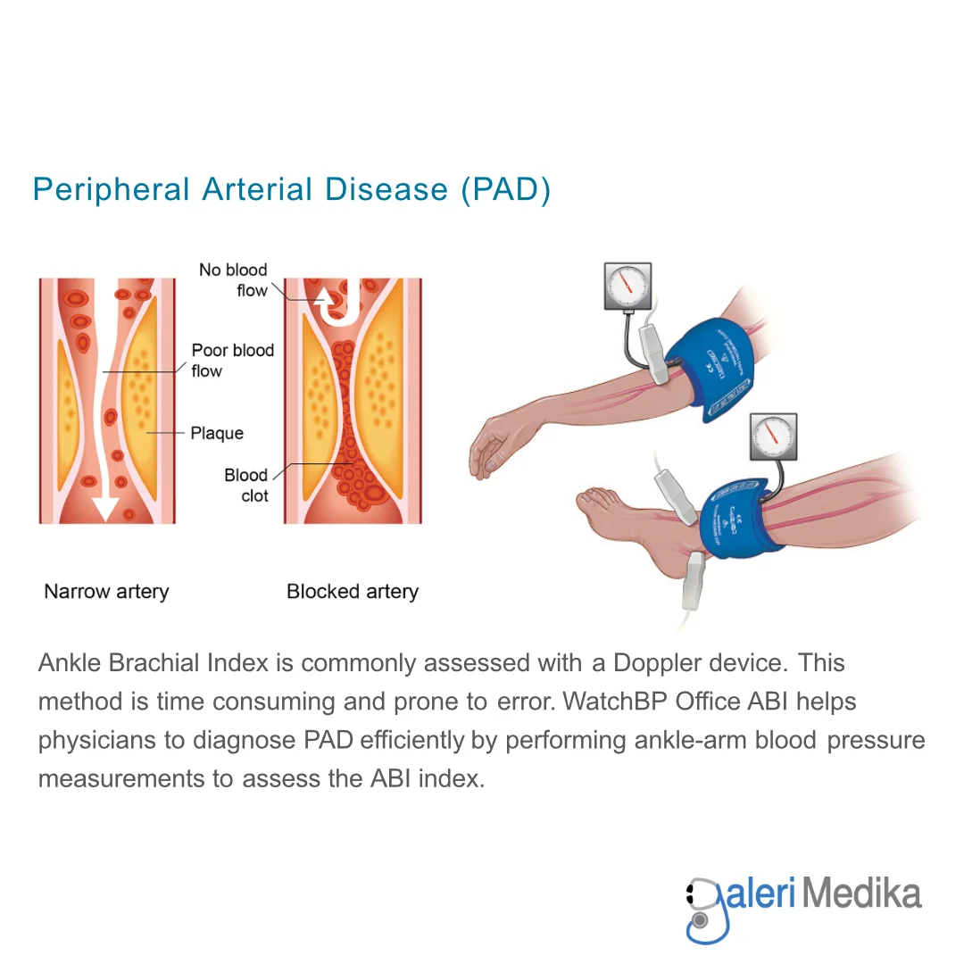Tensimeter Digital Klinis Microlife WatchBP Office ABI Twin 200 Cardiovascular Screening Monitor