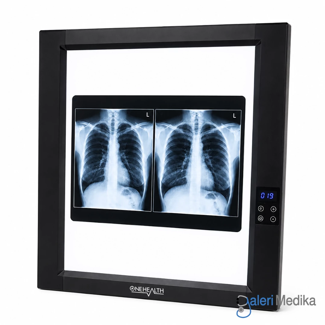 X-Ray Film Viewer OneHealth OH-VL-011 Single Slide Lampu LED Rontgen