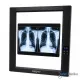 X-Ray Film Viewer OneHealth OH-VL-011 Single Slide Lampu LED Rontgen