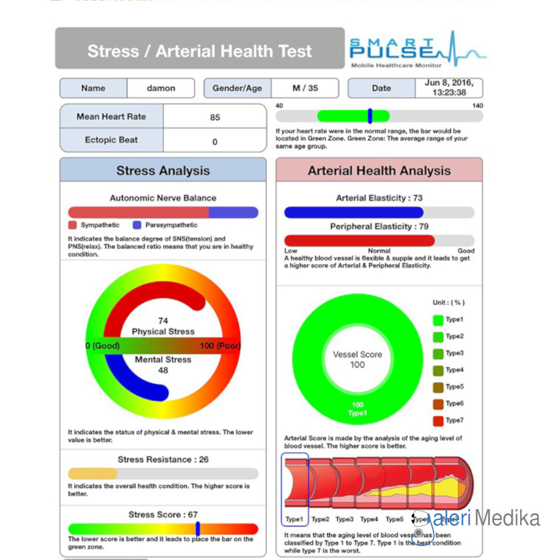 Smart Pulse Stress Analyzer - Versi Android | Galeri Medika
