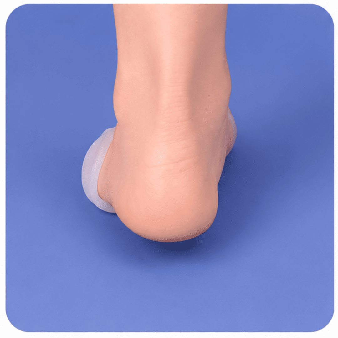Pelindung Jari Kaki Variteks 550 Silicone Bunion Shield Pelindung Jari Kaki Variteks 550 Silicone Bunion Shield