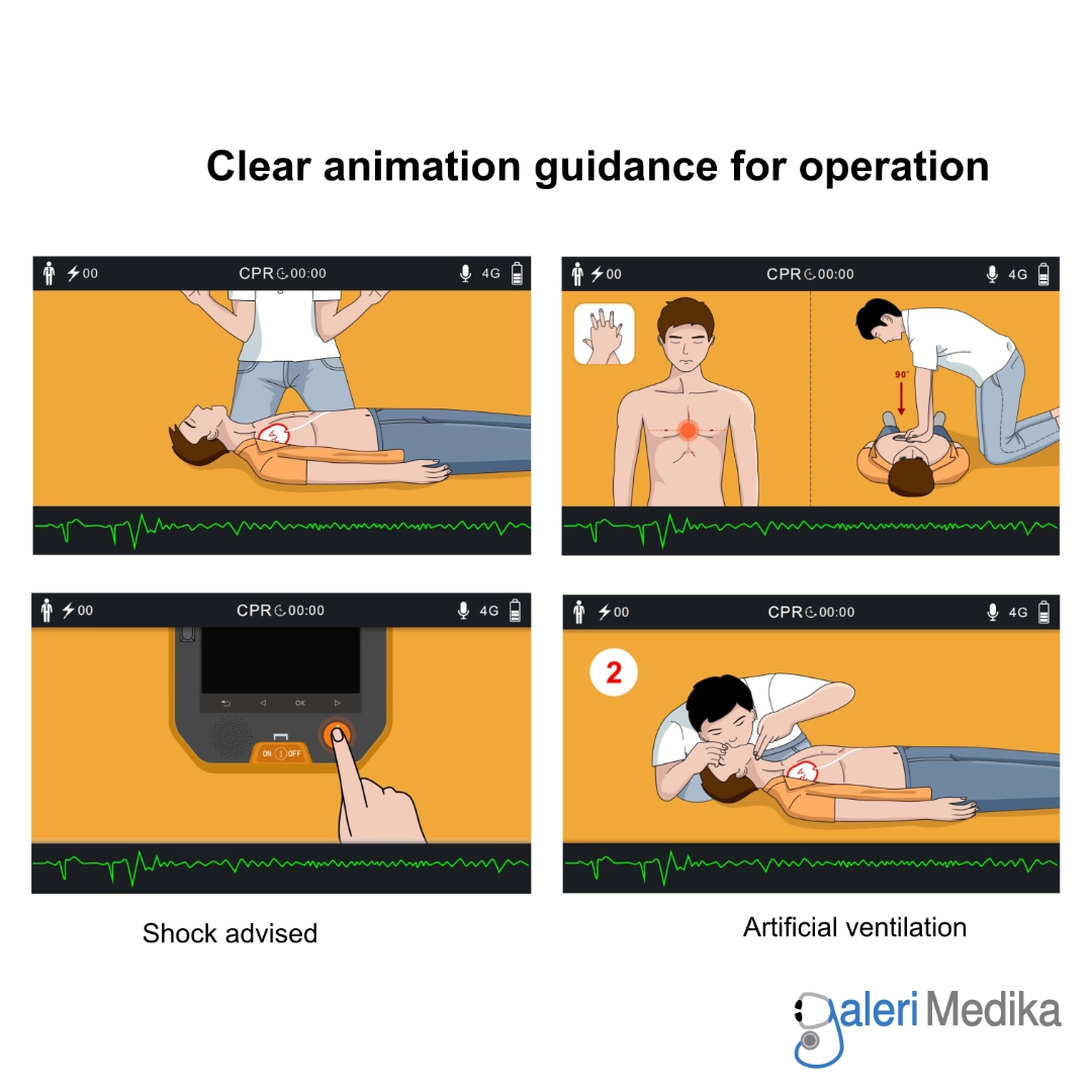 Amoul i9 AED Color Screen Semi-Automatic Defibrillator Amoul i9 AED Color Screen Semi-Automatic Defibrillator