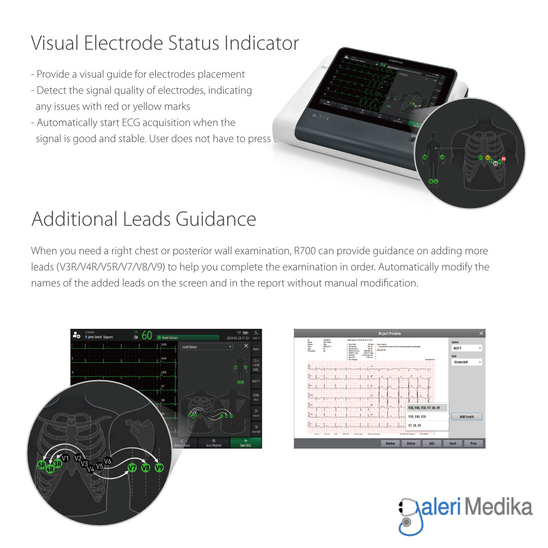 Mindray BeneHeart R700 Electrocardiograph ECG Machine 12-Lead Resting Mindray BeneHeart R700 Electrocardiograph ECG Machine 12-Lead Resting