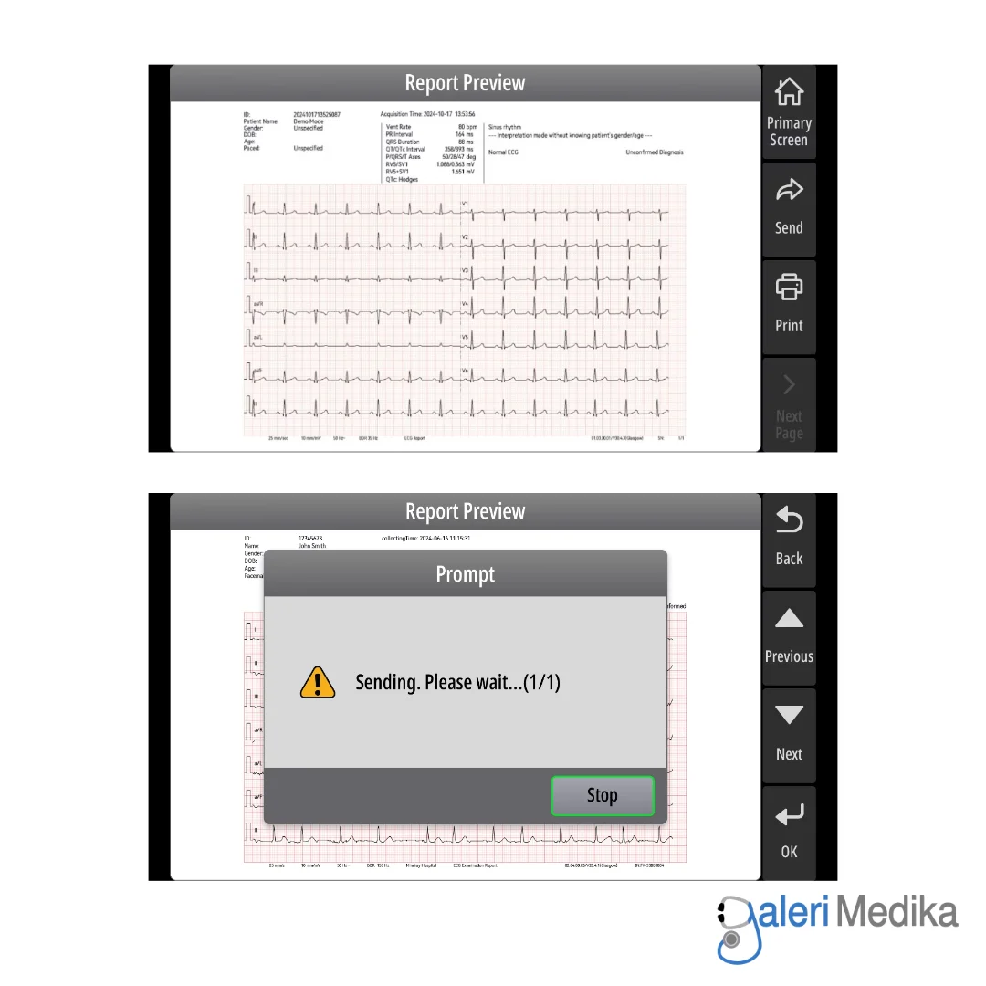 Mindray BeneHeart R300 Electrocardiograph ECG Machine 12-Lead Mindray BeneHeart R300 Electrocardiograph ECG Machine 12-Lead