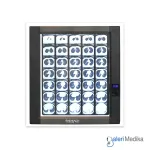 X-Ray Film Viewer OneHealth OH-VL-011 Single Slide Lampu LED Rontgen