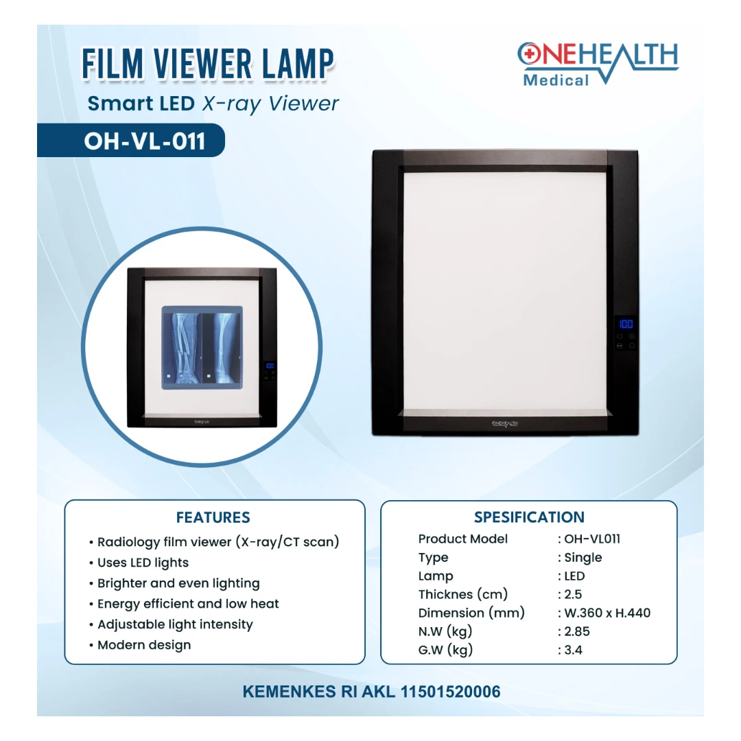 X-Ray Film Viewer OneHealth OH-VL-011 Single Slide Lampu LED Rontgen