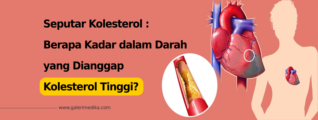 Berapa Kadar dalam Darah yang Dianggap Kolesterol Tinggi?