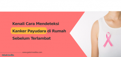 Kenali Cara Mendeteksi Kanker Payudara di Rumah Sebelum Terlambat