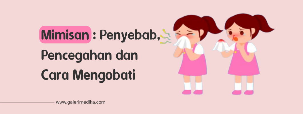 Mimisan : Penyebab, Pencegahan dan Cara Mengobati