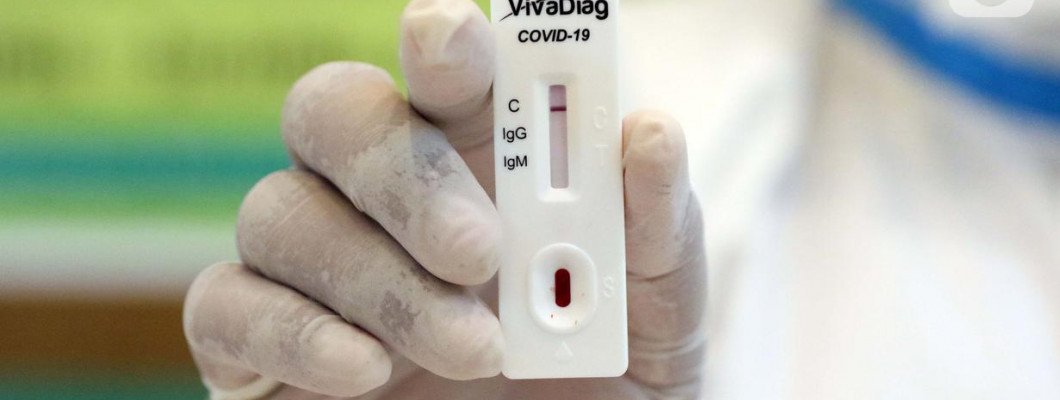 Memahami Cara Kerja Rapid Test Untuk Virus COVID-19