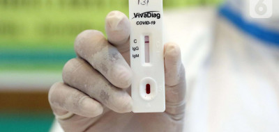 Memahami Cara Kerja Rapid Test Untuk Virus COVID-19
