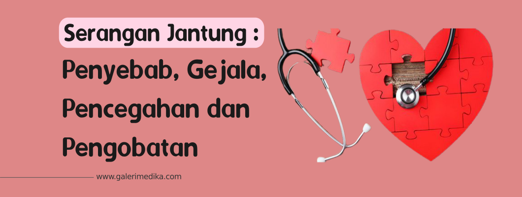 Serangan Jantung : Penyebab, Gejala, Pencegahan dan Pengobatan