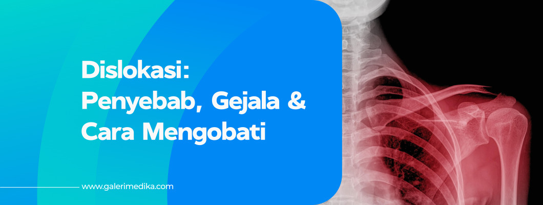 Penyebab Dislokasi dan Bagaimana Cara Mengobati