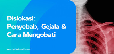 Penyebab Dislokasi dan Bagaimana Cara Mengobati