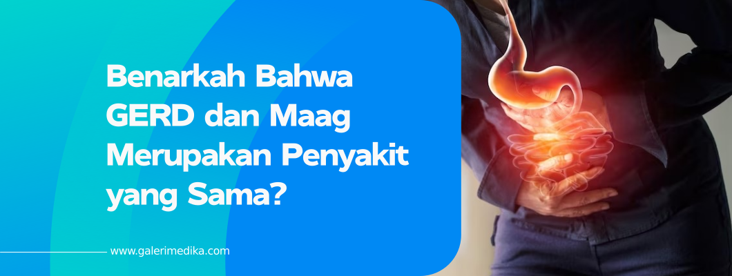 Benarkah Bahwa GERD dan Maag Merupakan Penyakit yang Sama?