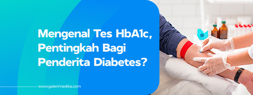 Apa Itu Tes HbA1c? Pentingkah Bagi Penderita Diabetes?
