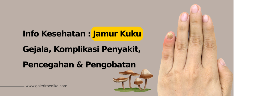 Jamur Kuku: Gejala, Komplikasi, Pencegahan dan Pengobatan