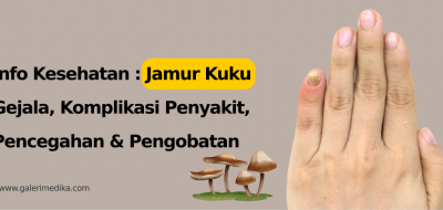 Jamur Kuku: Gejala, Komplikasi, Pencegahan dan Pengobatan