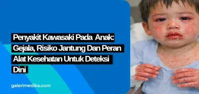 Penyakit Kawasaki pada Anak: Gejala, Risiko Jantung, dan Peran Alat Kesehatan untuk Deteksi Dini
