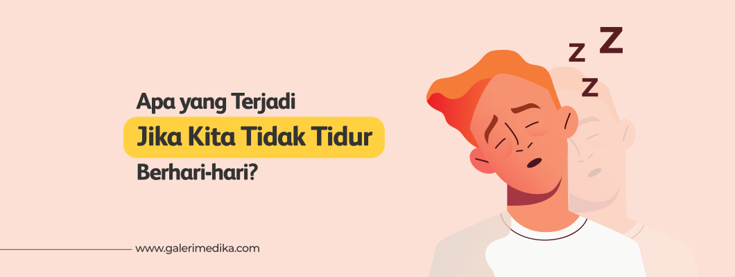 Apa yang Terjadi Jika Kita Tidak Tidur Berhari-hari?