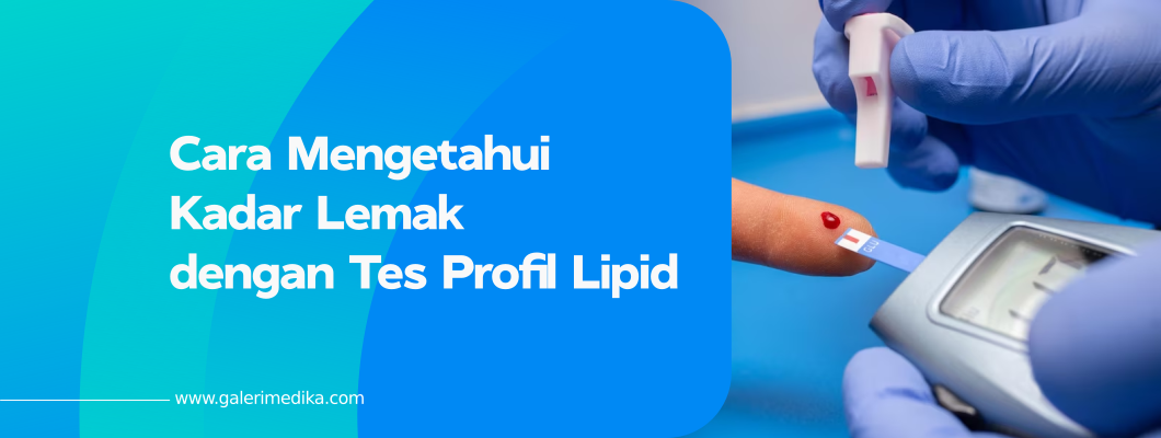 Cara Mengetahui Kadar Lemak dengan Tes Profil Lipid