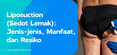 Liposuction (Sedot Lemak): Jenis-jenis, Manfaat, dan Resiko