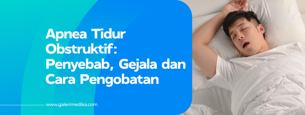 Apnea Tidur Obstruktif