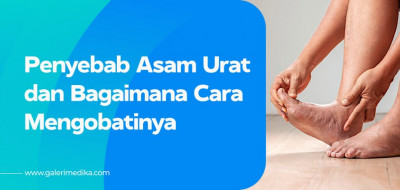 Penyebab Asam Urat dan Cara Mengobatinya