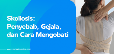Skoliosis: Penyebab, Gejala, dan Cara Mengobati
