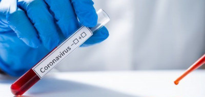 Rapid Tes Covid-19 Kurang Efektif, PCR Lebih Akurat