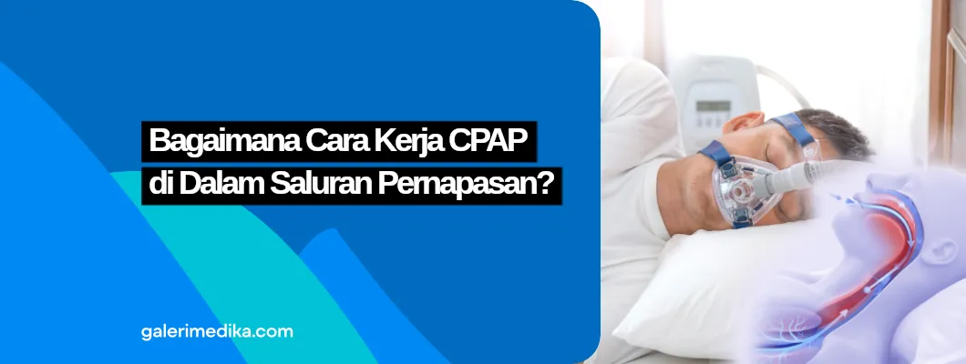 Bagaimana Cara Kerja CPAP di Dalam Saluran Pernapasan?