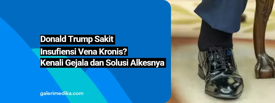 Donald Trump Sakit Insufiensi Vena Kronis? Kenali Gejala dan Solusi Alkesnya Donald Trump Sakit Insufiensi Vena Kronis? Kenali Gejala dan Solusi Alkesnya