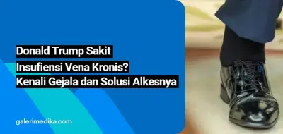 Donald Trump Sakit Insufiensi Vena Kronis? Kenali Gejala dan Solusi Alkesnya