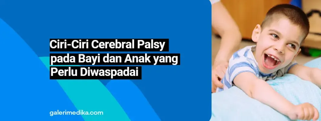 Ciri-Ciri Cerebral Palsy pada Bayi dan Anak yang Perlu Diwaspadai Ciri-Ciri Cerebral Palsy pada Bayi dan Anak yang Perlu Diwaspadai
