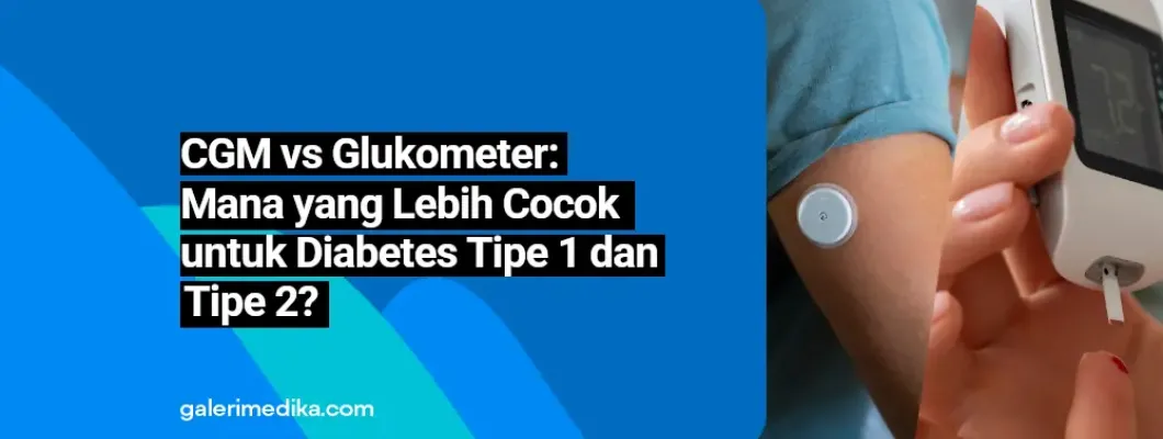 CGM vs Glukometer: Mana yang Lebih Cocok untuk Diabetes Tipe 1 dan Tipe 2?