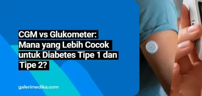 CGM vs Glukometer: Mana yang Lebih Cocok untuk Diabetes Tipe 1 dan Tipe 2?