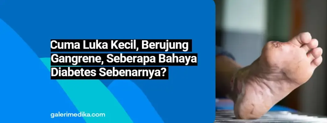 Cuma Luka Kecil, Berujung Gangren, Seberapa Berbahaya Diabetes Sebenarnya?