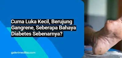 Cuma Luka Kecil, Berujung Gangren, Seberapa Berbahaya Diabetes Sebenarnya?