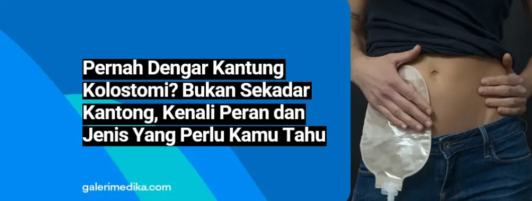 Pernah Dengar Kantung kolostomi? Bukan Sekadar Kantong, Kenali Fakta, Peran dan Jenis Yang Perlu Kamu Tahu