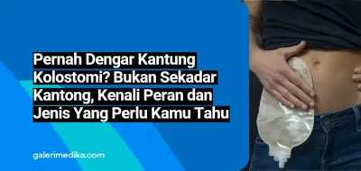 Pernah Dengar Kantung kolostomi? Bukan Sekadar Kantong, Kenali Fakta, Peran dan Jenis Yang Perlu Kamu Tahu
