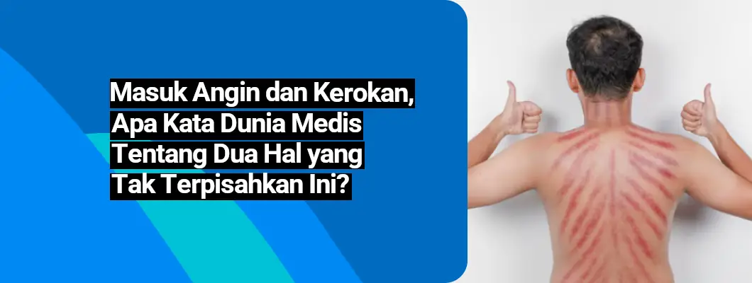 Masuk Angin dan Kerokan, Apa Kata Dunia Medis Tentang Dua Hal yang Tak Terpisahkan Ini?