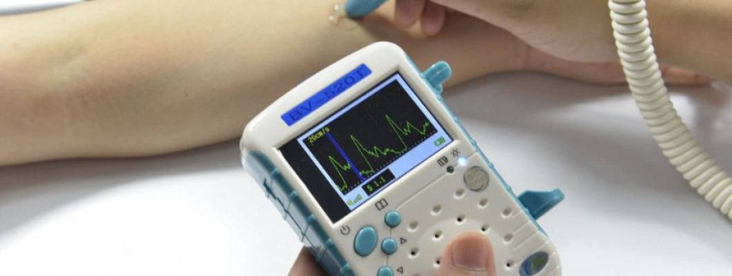 Cara Kerja Vascular Doppler, Alat Deteksi Sumbatan Aliran Darah