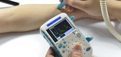 Cara Kerja Vascular Doppler, Alat Deteksi Sumbatan Aliran Darah