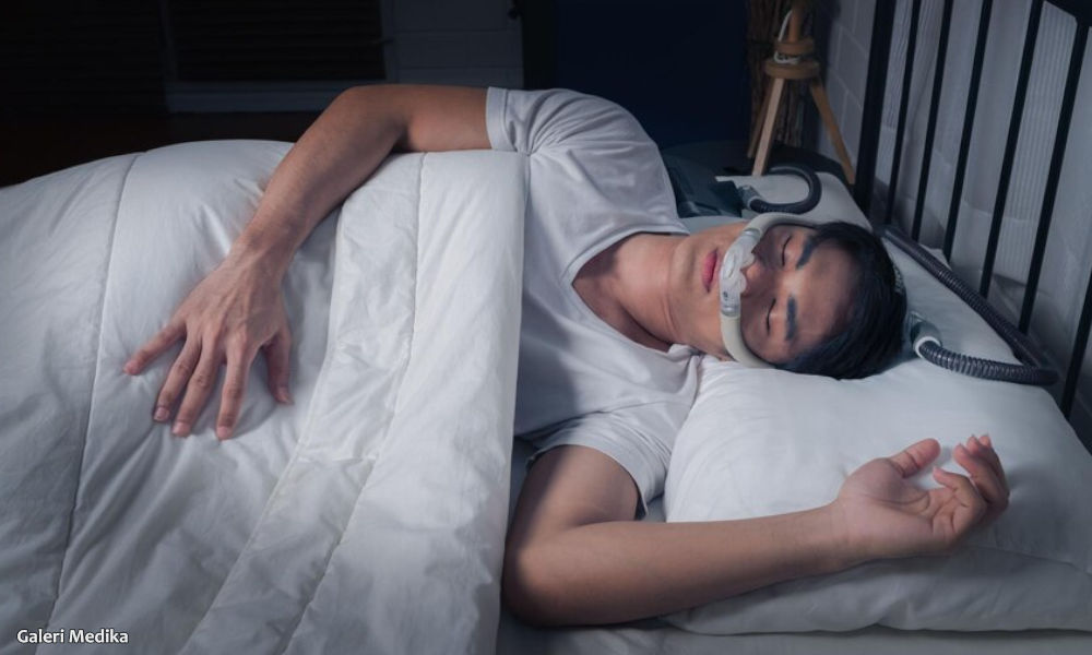 APAP vs CPAP, Lebih Cocok Mana untuk Penderita Sleep Apnea?