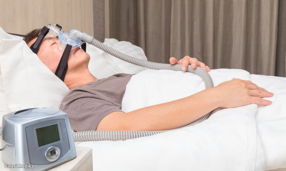 APAP vs CPAP, Lebih Cocok Mana untuk Penderita Sleep Apnea?