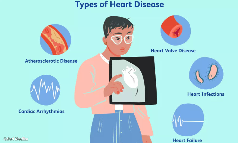Pantau Kesehatan Jantung Jadi Mudah dengan Omron HEM-7530T